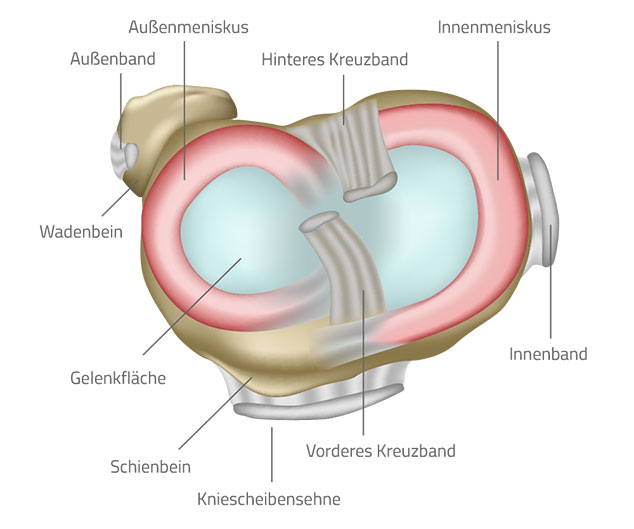 Grafische Darstellung eines Meniskus